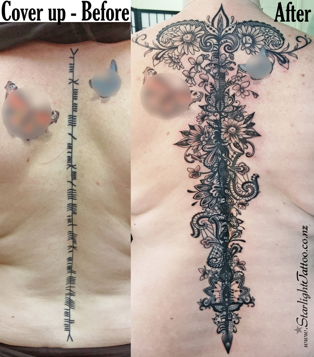 Spine cover up