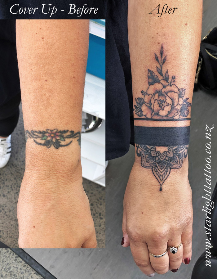 Mandala tattoo cover-up in Auckland with layered symmetry