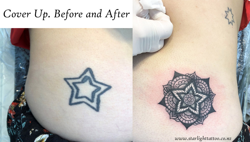 Mandala cover-up tattoo with balanced symmetry and sacred geometry